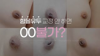 함몰유두, 교정 안 하면 oo불가?😵함몰유두의 유형과 수술 방법 알아보기