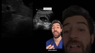 “I’ll Wait for It to Pass Naturally” #miscarriage