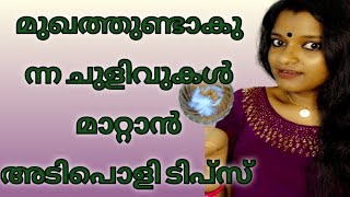 മുഖത്തെ ചുളിവുകൾ മാറാൻ ഒരു അടിപൊളി ടിപ്സ് /How to Remove wrinkles Naturally