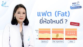 [ล่าสุด 2024] แฟต (Fat) ยี่ห้อไหนดี แต่ละยี่ห้อต่างกันอย่างไร ? l หมอ V Square แชร์หมดเปลือก