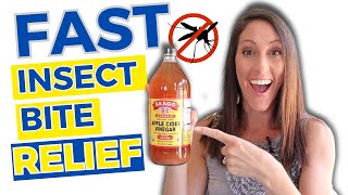 Natural Mosquito Bite Itch Relief with Apple Cider Vinegar | FAST
