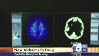 Salk News Clip - Alzheimer's Drug Candidate (CW6)