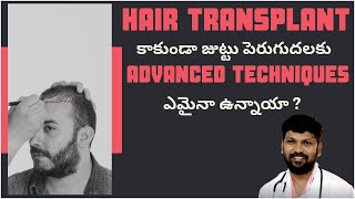 #AskDrJohnWatts | Frequently Asked Questions (FAQ)  | Best Hair Specialist in Hyderabad Explains
