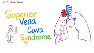 Superior Vena Cava (SVC) Syndrome | Pancoast Tumor | Pathology | Oncology | 5-Minute-Review