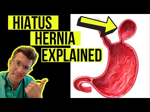 How did I get a hiatus hernia?