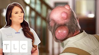 Man Has Water Balloon Ticking Time Bomb On The Back Of Head | Dr. Pimple Popper