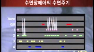 생로병사의 비밀 - Mysteries of the Human Body 20060711 #006