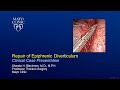 Epiphrenic Diverticulectomy Talk