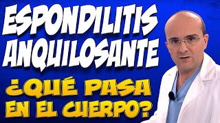 ESPONDILITIS ANQUILOSANTE - ¿Qué pasa dentro del cuerpo de las personas que la padecen?