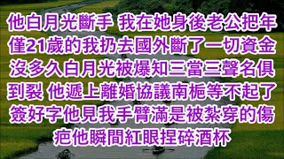 他白月光斷手 我在她身後老公把年僅21歲的我扔去國外斷了一切資金沒多久白月光被爆知三當三聲名俱到裂 他遞上離婚協議南梔等不起了簽好字他見我手臂滿是被紮穿的傷疤他瞬間紅眼捏碎酒杯