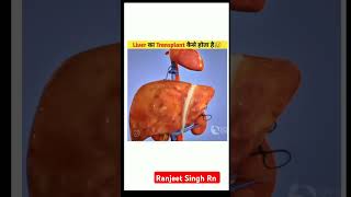 Liver transplant #healthcare #anatomy #shortvideo #liver