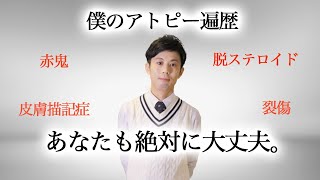 アトピーで、辛い思いをされてるあなたへ。僕のアトピー遍歴を告白します。