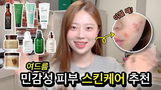 여드름 민감성 피부에 정말 좋은 스킨케어 '찐' 추천템💚🍃 오늘도 썼어요➰ (클렌징부터 크림까지)