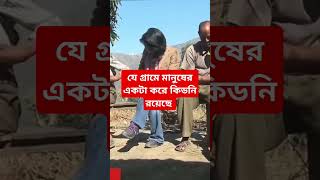 চলুন দেখে আসি যে গ্রামের মানুষের একটা করে কিডনি রয়েছে। #2025shorts