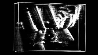 Dislocation tomography