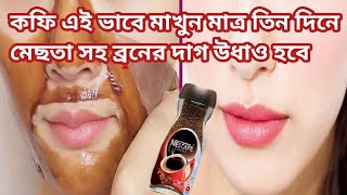 কফির সাথে ৩ টি জিনিস মিশিয়ে ব্রণের দাগ মেছতার দাগ মাএ ৩ দিনে উধাও ত্বক হবে কাচের মত চকচকে facepack