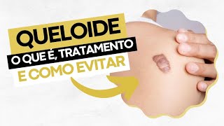 Queloide - o que é, tratamento e como evitar