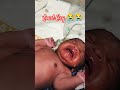 loud cry of Adorable newborn baby after birth immediately #Firstcry #Newborn #afterbirth #viral