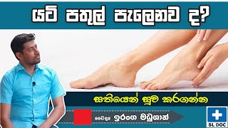 යටිපතුල් පැලෙනවද? | මෙන්න විසඳුම | SL Doc