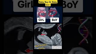 Baby Boy Or Baby Girl pregnancy Ultrasound V4 #babyboy #babygirl #girl #boy #ultrasound #pregnant