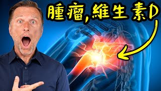 柏格醫生維生素D幾十年都不足！兒童小孩吃多少D3?自然療法,柏格醫生 Dr Berg