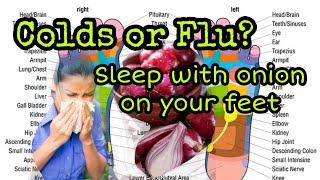 Colds or Flu? Sleep With Onion On Your Feet #health #trivia #homeremedies