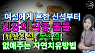 여성에게 흔한 신석부터 신장의 각종 돌들(요산신석, 녹각석, 시스틴신석) 없애주는 자연치유방법 [하늘마을 힐링센터 유소영 원장]