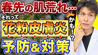 花粉がもたらす肌あれトラブル！花粉皮膚炎の原因、症状から対策まで徹底解説