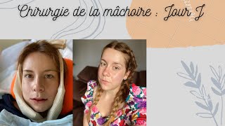 Chirurgie maxillo-faciale : Jour J - J+4