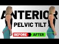 3 Yoga Exercises to FIX Anterior Pelvic Tilt | Goodbye BACK Pain