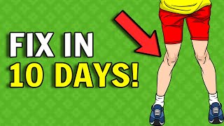Best Exercises For Knock Knees [Workout For Knock Knees With Stretching & Exercise]