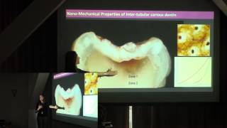 Illinois NanoBio Node - Nanohour Dec. 4,2012 - Modification of Dentin Matrices for Dental Therapies