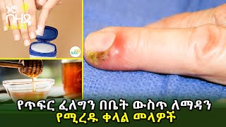 Ethiopia: የጥፍር ፈለግን በቤት ውስጥ ለማዳን የሚረዱ ቀላል መላዎች | Nuro Bezede Girls