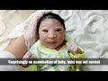 most beautiful special newborn baby after birth with small head and black eyes usa