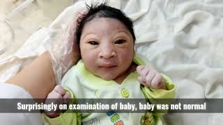 Most beautiful special newborn baby after birth with small Head and black eyes #usa