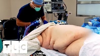 Doug Has Surgery to Aid Weightloss | My 600-lb Life