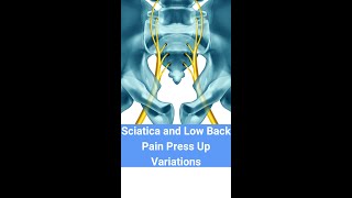 Prone Press Up Variations - Manual Therapy for Sciatica