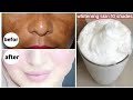 Japanese secret to whitening 10 shades, eliminates pigmentation and wrinkles