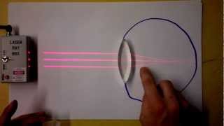 Optometry 102 | Finding Refractive Power (Diopters) Worked Examples | Doc Physics Optometry 102 | Finding Refractive Power (Diopters) Worked Examples | Doc Physics