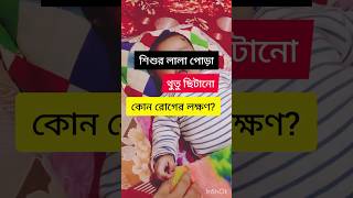 😱শিশুর লালা পোড়া থুতু ছিটানো কোন রোগের লক্ষণ 😱shorts/video/subscribe plz ☺️ ☺️🥰