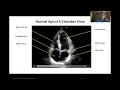 Normal Apical 4-Chamber View and Ejection Fraction Assessment with the Butterfly iQ