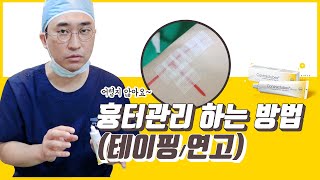 가슴축소수술 후 흉터 관리법(스테리스트립/콘트라투벡스 흉터연고)