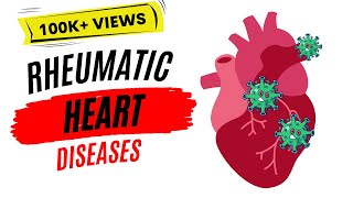 Rheumatic heart disease | Rheumatic fever |