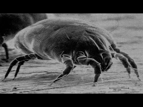 15 Ways to Get Rid of DUST MITES Quickly 15 Ways to Get Rid of DUST MITES Quickly