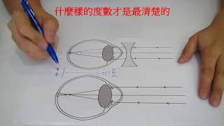 【專業知識分享】126~什麼樣的度數才是最清楚的