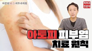 아토피 피부염 치료 가능합니다