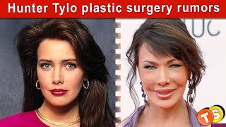 B B Alum Plastic Surgery Shocker Did Hunter Tylo Get Cosmetic Help