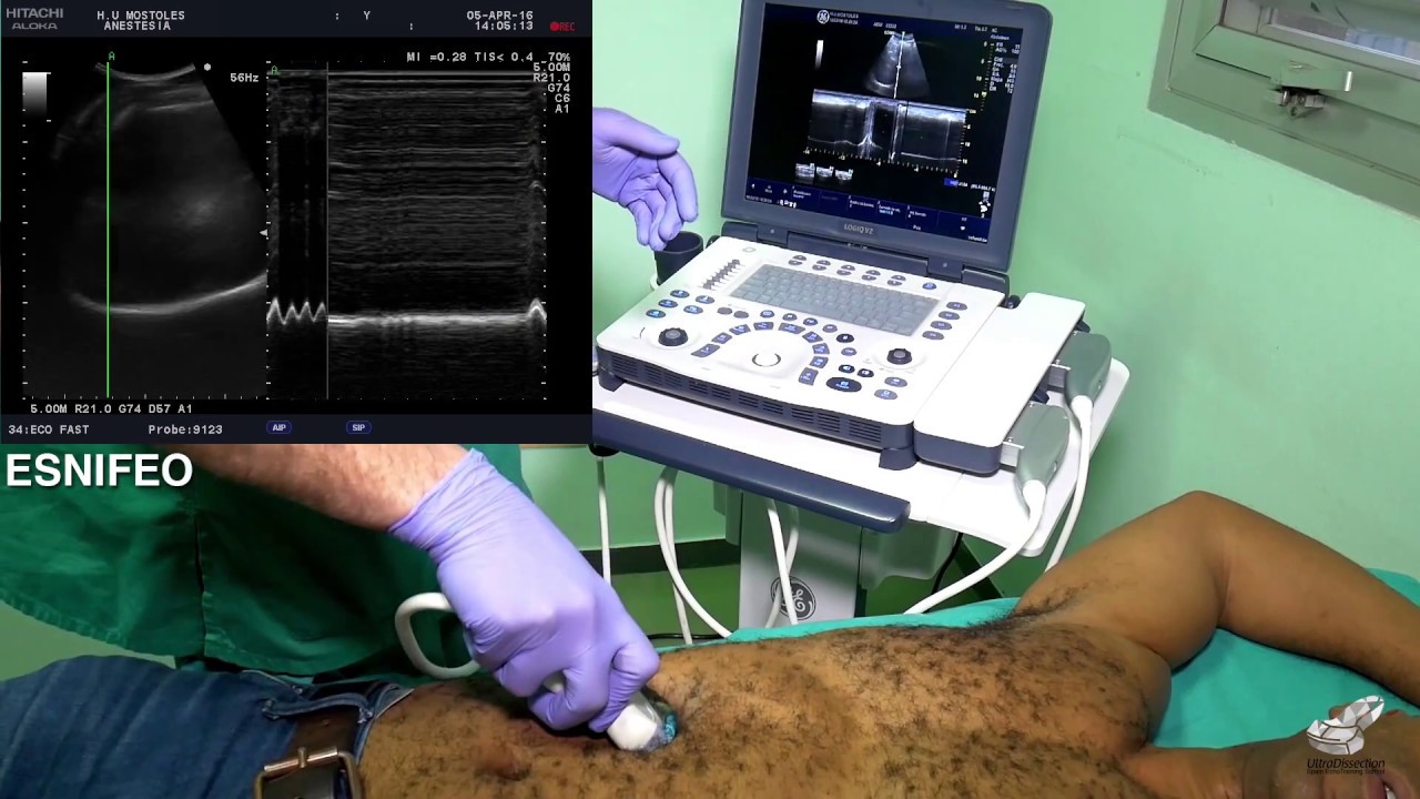 Ecografía Pulmonar Y Diafragmática/Lung Ultrasound - YouTube