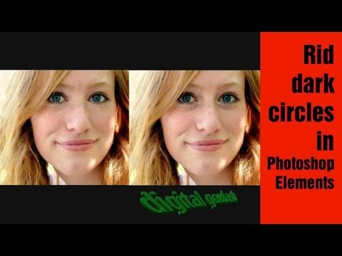 Learn Photoshop Elements - Getting rid of dark circles under the eye Learn Photoshop Elements - Getting rid of dark circles under the eye