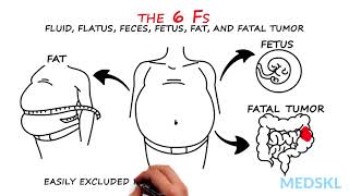 Abdominal Distension: The 6 Fs that can help your diagnosis
